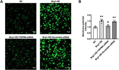 Brg1 and RUNX1 synergy in regulating TRPM4 channel in mouse cardiomyocytes